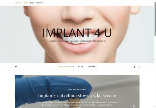 implant4u.pl