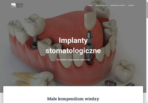 implantologia.pl