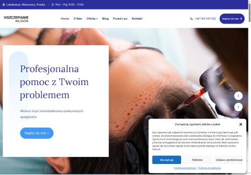 wszczepianiewlosow.pl